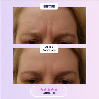 Noralios™ Silicone Collagen Sheet