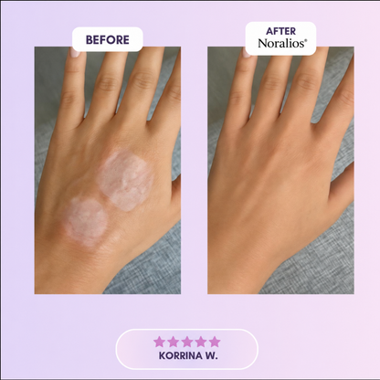 Noralios™ Silicone Collagen Sheet