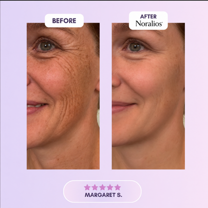 Noralios™ Silicone Collagen Sheet